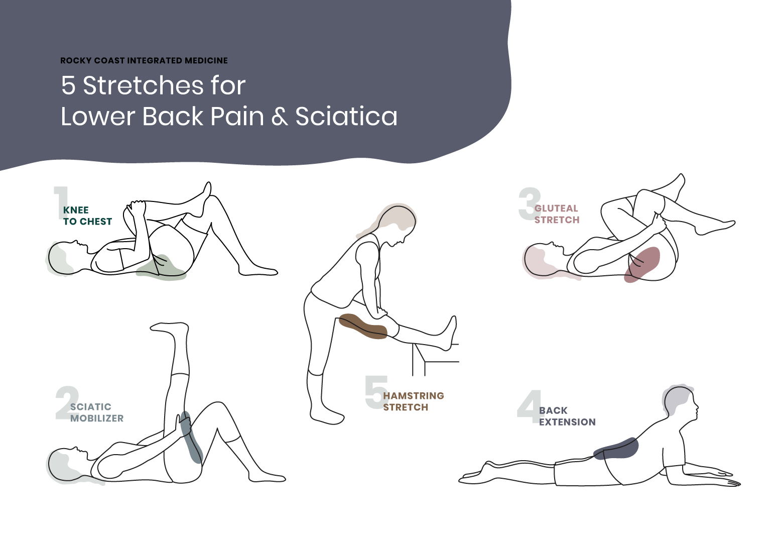 Sciatica